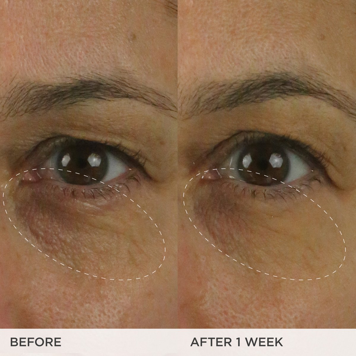 BrighteningEyeCream-pdp-BA-Clinicals-1200x1200_091301b3-25df-4376-8e87-88ef2f727882.jpg
