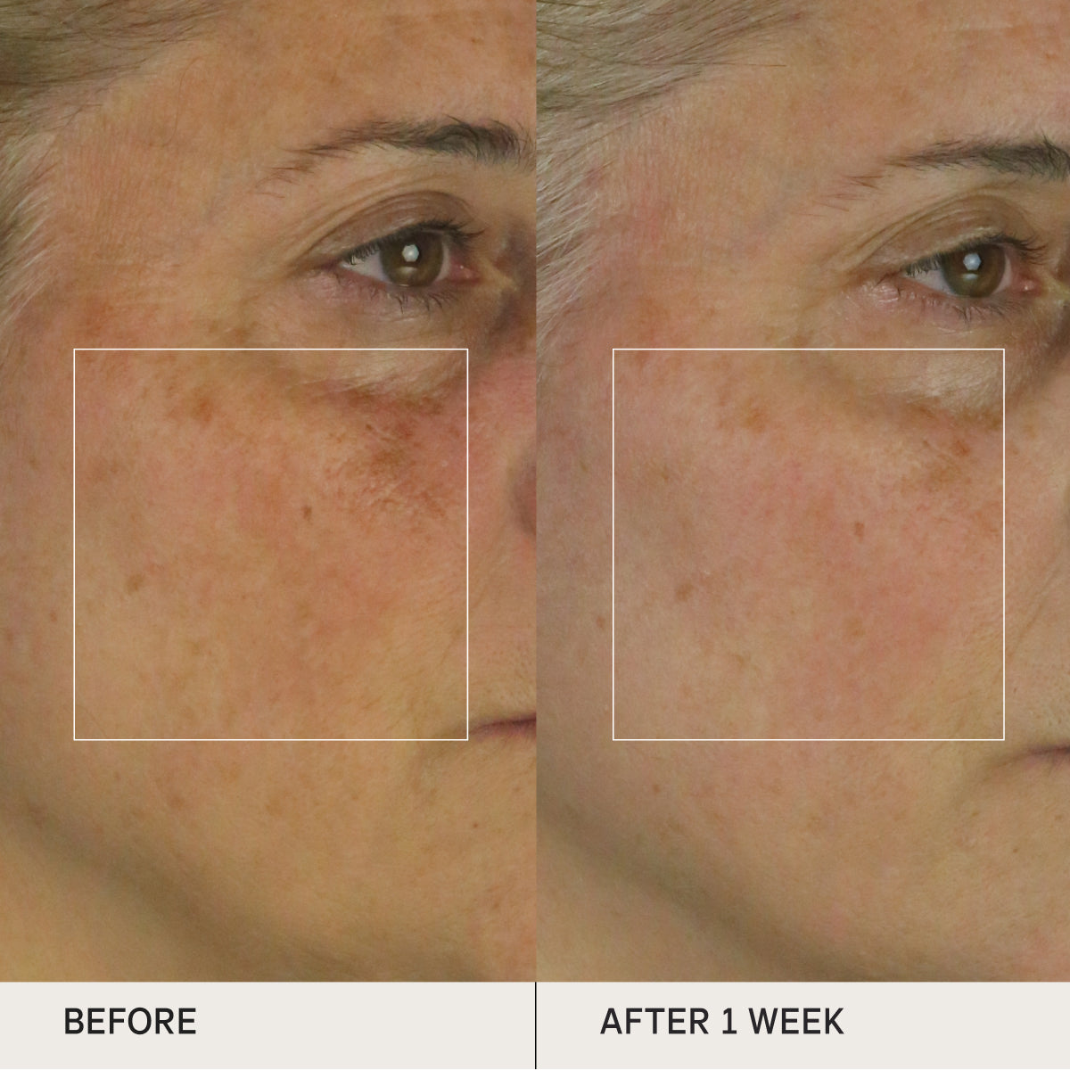 BrighteningSerum-Aug26-Ppage-Clinicals_e441bdb6-b683-4b52-983b-97070bd112c3.jpg