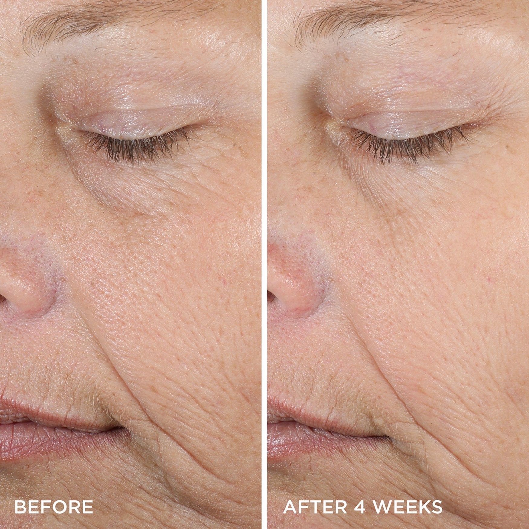 DewySerum-pdp-BeforeAfter-1200x1200_c0859ba5-e407-46c7-a55b-255d044eed59.jpg
