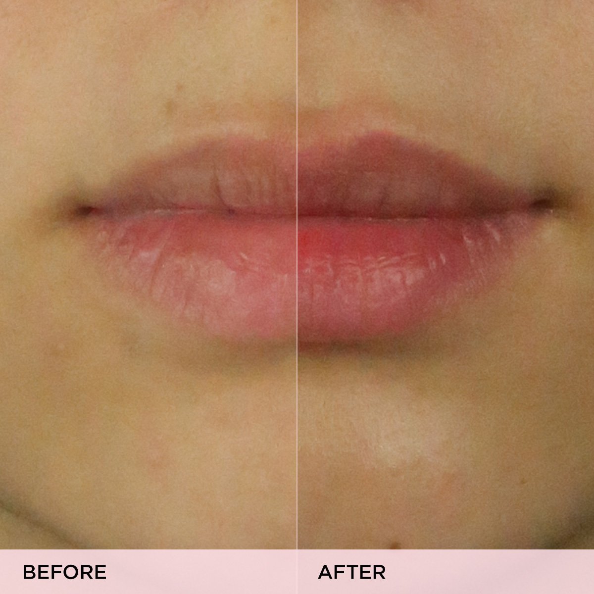 KissuLipScrub-pdp-Clinicals-1200x1200_aa3d492c-3915-4318-b86f-8cbbd346087e.jpg