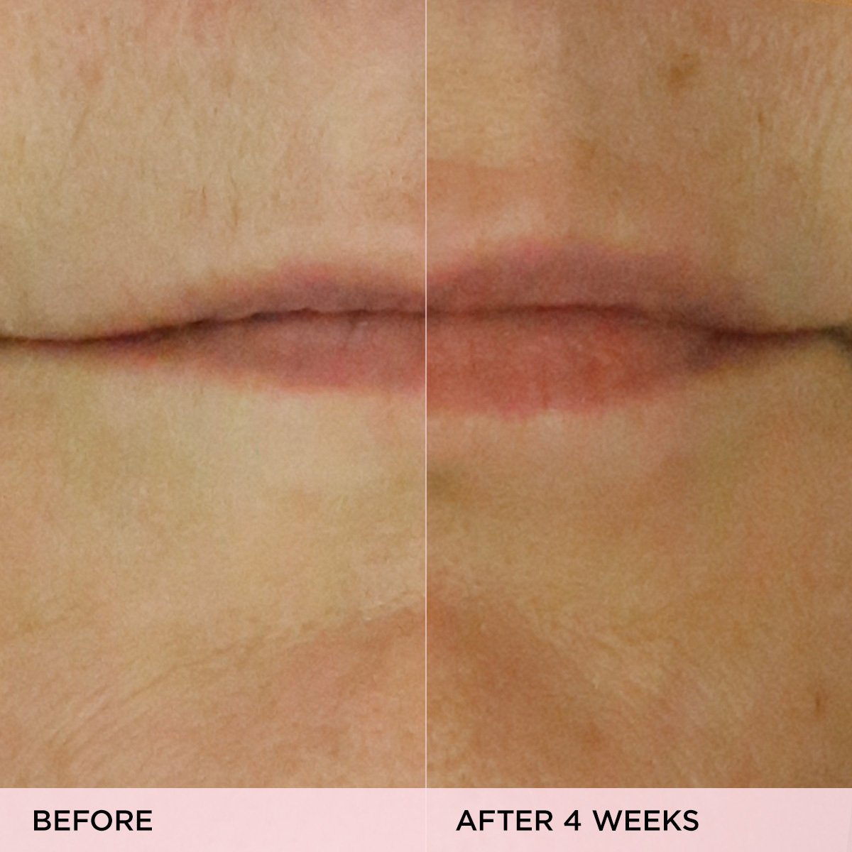 KissuLipTreatment-pdp-Clinicals-1200x1200_098cccd0-b9e0-4c16-b44f-b0706f385425.jpg
